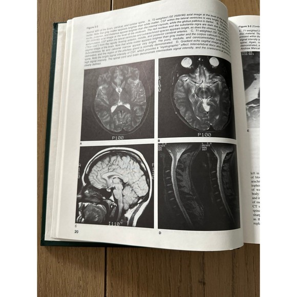 Fifth Edition Principles Of Neurology Raymond D. Adams Maurice Victor Hardcover - Picture 9 of 9